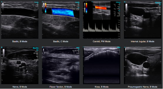 手持式超声波准确吗？
