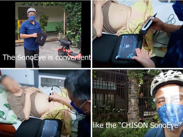 手持式超声在菲律宾的临床价值