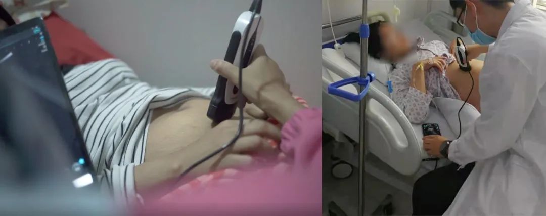 SonoEye 在产科中的应用