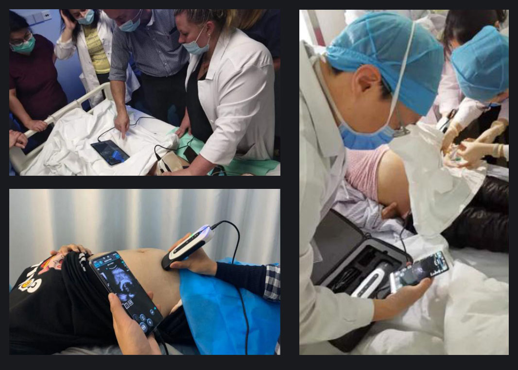 CHISON SonoEye 的愿景是增强女性健康。