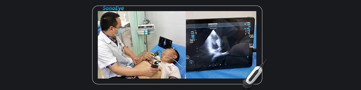 SonoEye 在心脏应用中的应用