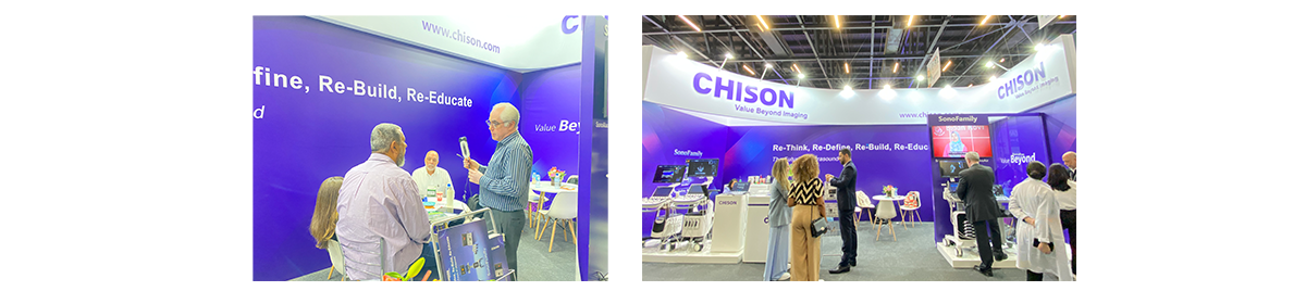 在 2024 年 Hospitalar 展会上使用 SonoEye 捕捉珍贵瞬间