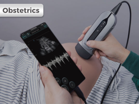SonoEye 产科