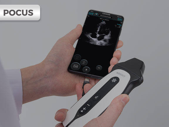 The Point-of-Care Ultrasound (POCUS) Revolution