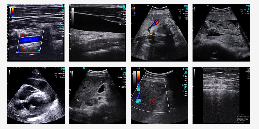 Authoritative Findings: SonoEye Hailed as Premier Ultrasound Device