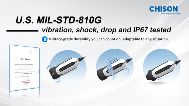 Mastering SonoEye: A Beginner's Guide to Portable Handheld Ultrasound for Clinical Efficiency