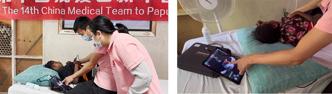 Bringing Care to the Unreachable: SonoEye in Action