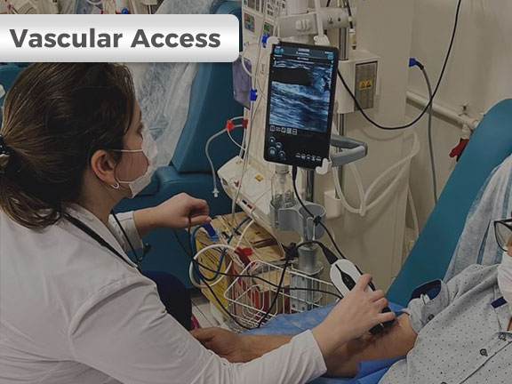 Handheld Ultrasound for Vascular Access